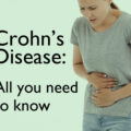 Crohns-Disease