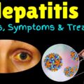 Hepatis B Disease