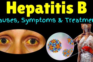 Hepatis B Disease