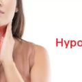 Hypothyrodism Disease.