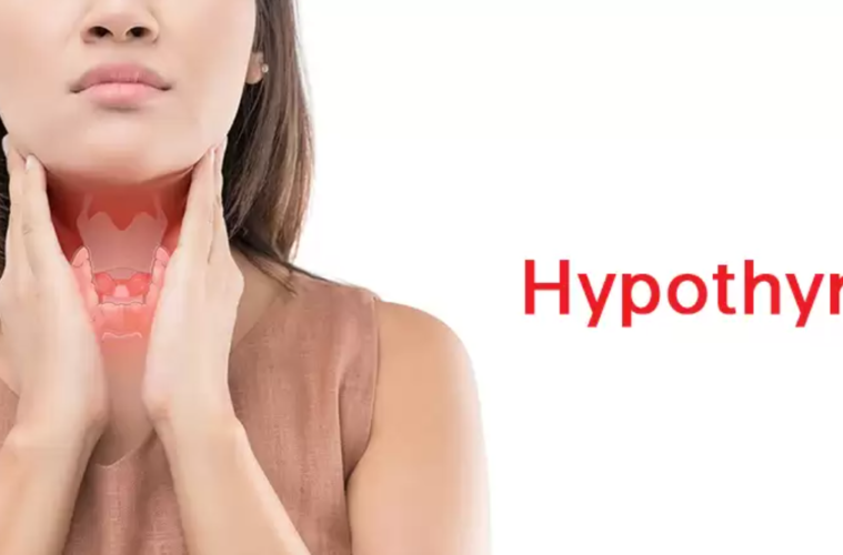 Hypothyrodism Disease.