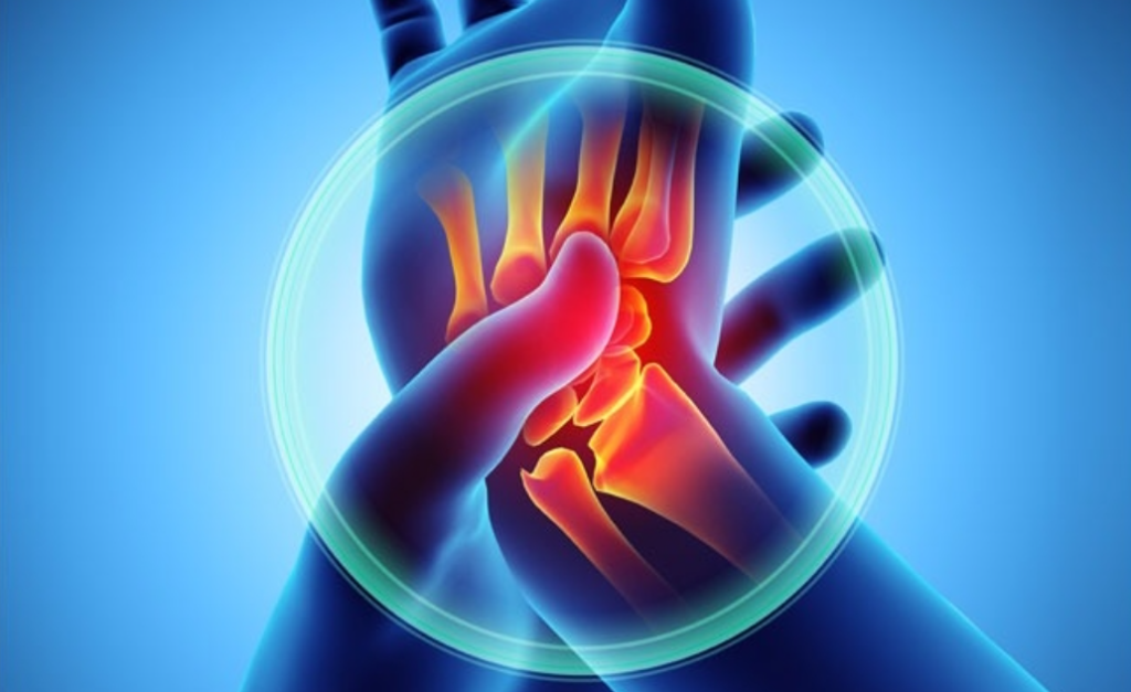 Emotional Rheumatoid-Arthritis