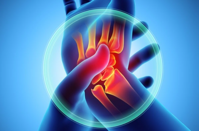 Emotional Rheumatoid-Arthritis