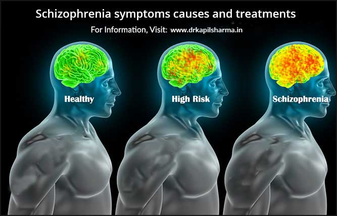 Schizophrenia