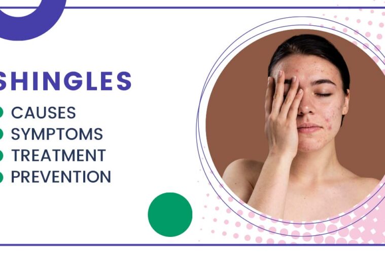 Shingles treatment